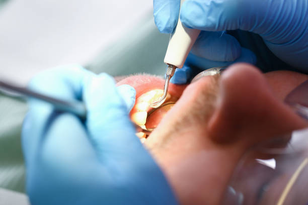Best Emergency Dental Care for Broken or Chipped Teeth in Springdale, AR