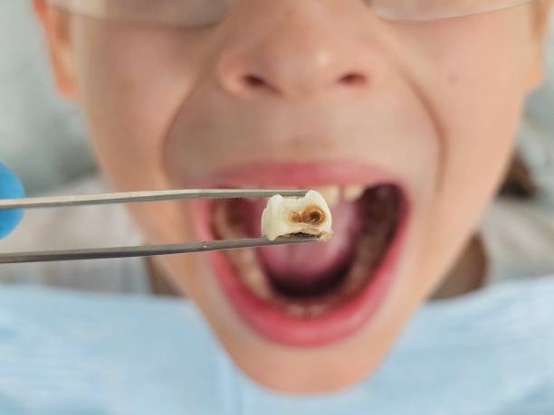 Best Cosmetic Emergency Dentistry in Springdale, AR